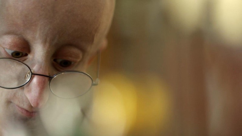 Xem Phim Góc Nhìn Cuộc Sống Của Sam, Life According to Sam 2013 Xem Phim Góc Nhìn Cuộc Sống Của Sam, Life According to Sam 2013